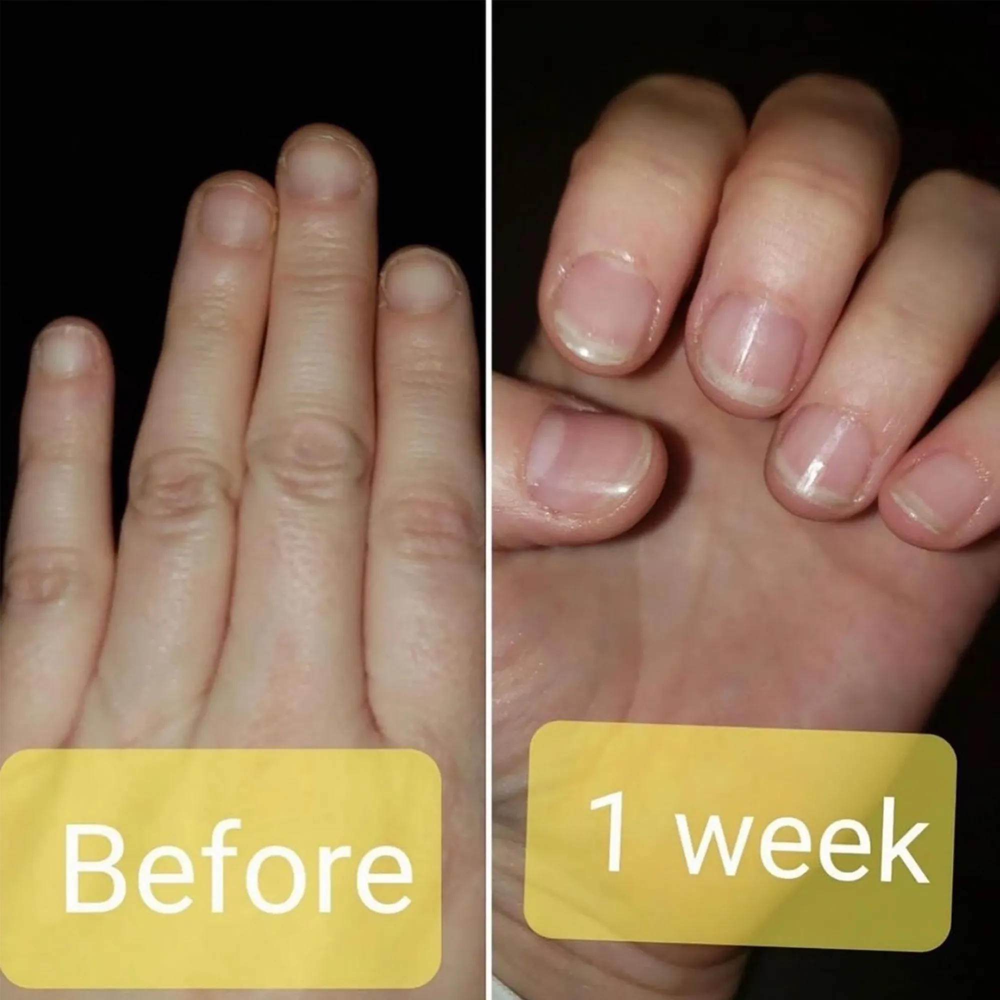 Damage Control (horsetail plant nail strengthener)